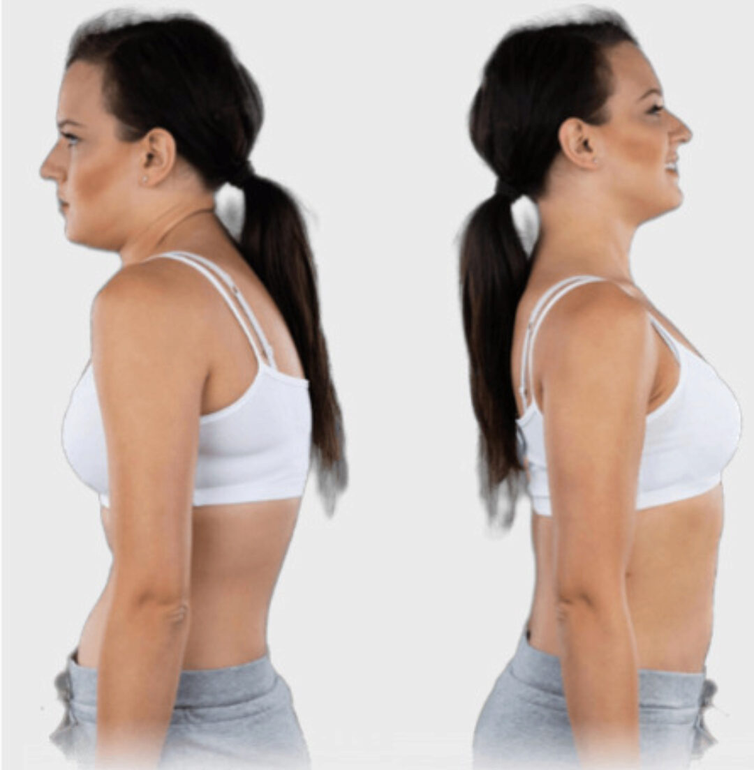 Антисутулость 2.0. Избавьтесь от сутулости за 2 недели (Дмитрий Кириченко)