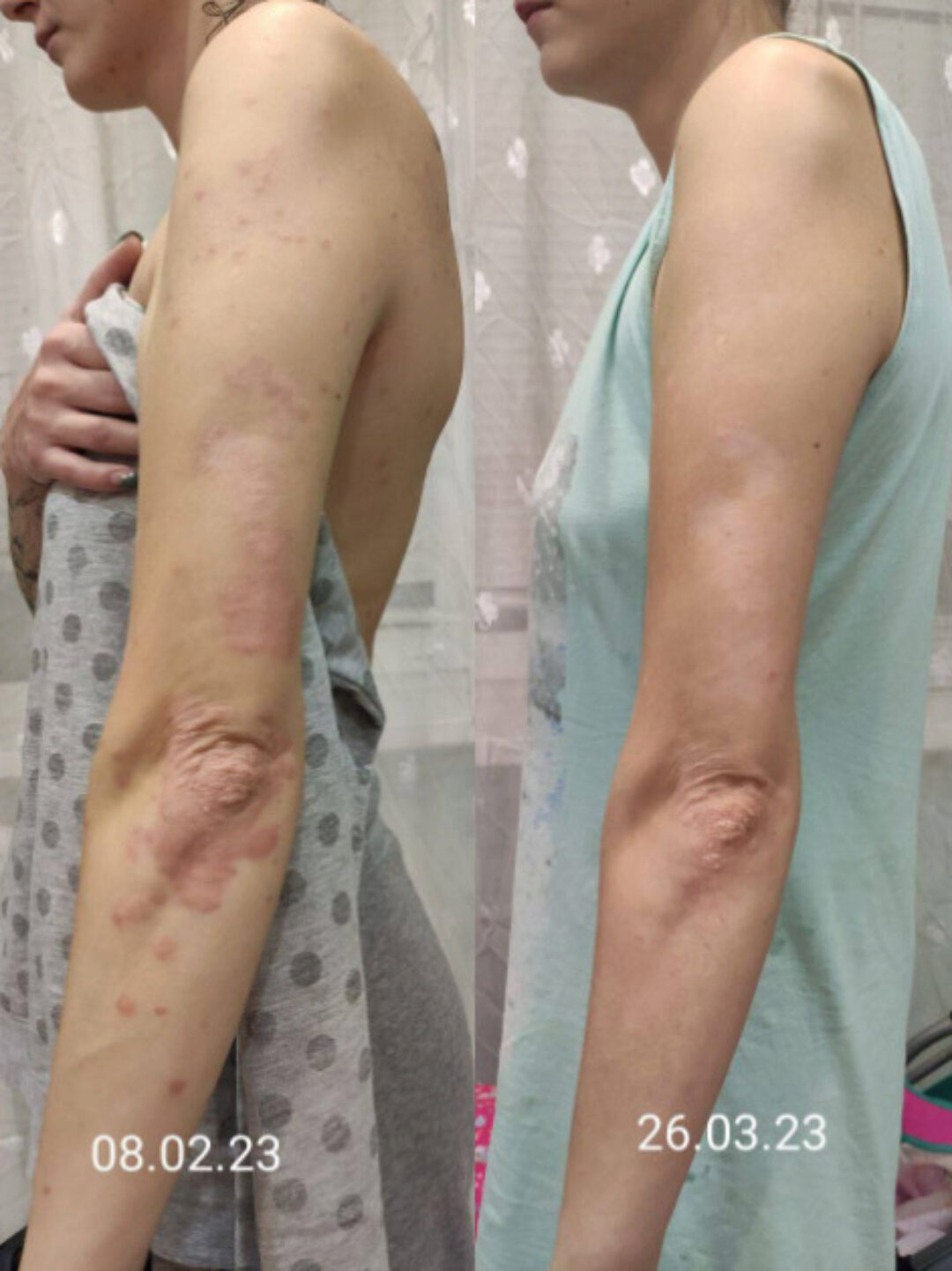 Легендарный прочистон (Алёна Ковальчук)