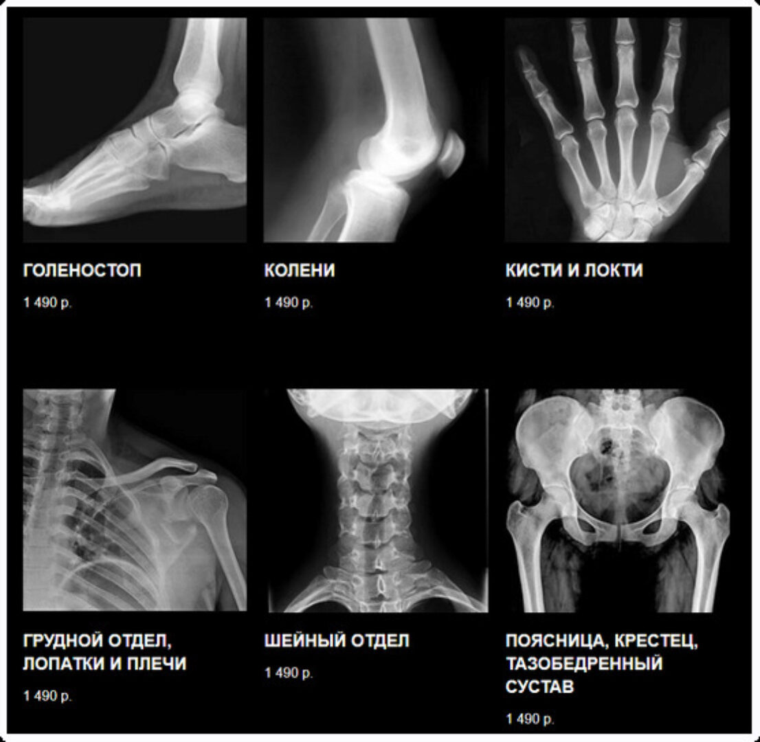 Полный курс ЛФК. Все 6 лекций (Виктор Блуд, Владимир Демченко)