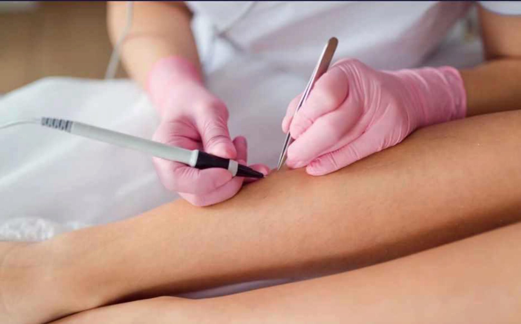 [zerkaloepil] Совеременная Электроэпиляция. Электроэпиляция в идеальном исполнении. Базовый курс