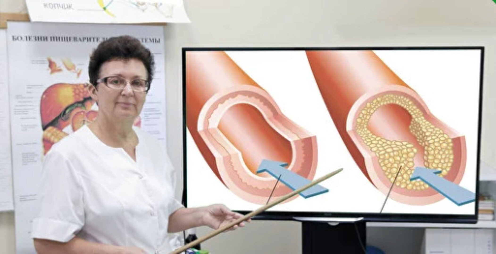 Здоровые сосуды. Варикозная болезнь. Геморрой (Ольга Шишова)