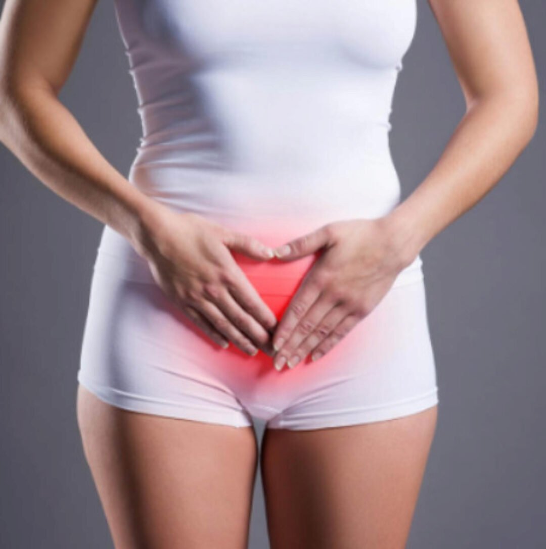 [Первая школа биохакинга] Цистит (Ирина Баранова, Людмила Угрюмова)