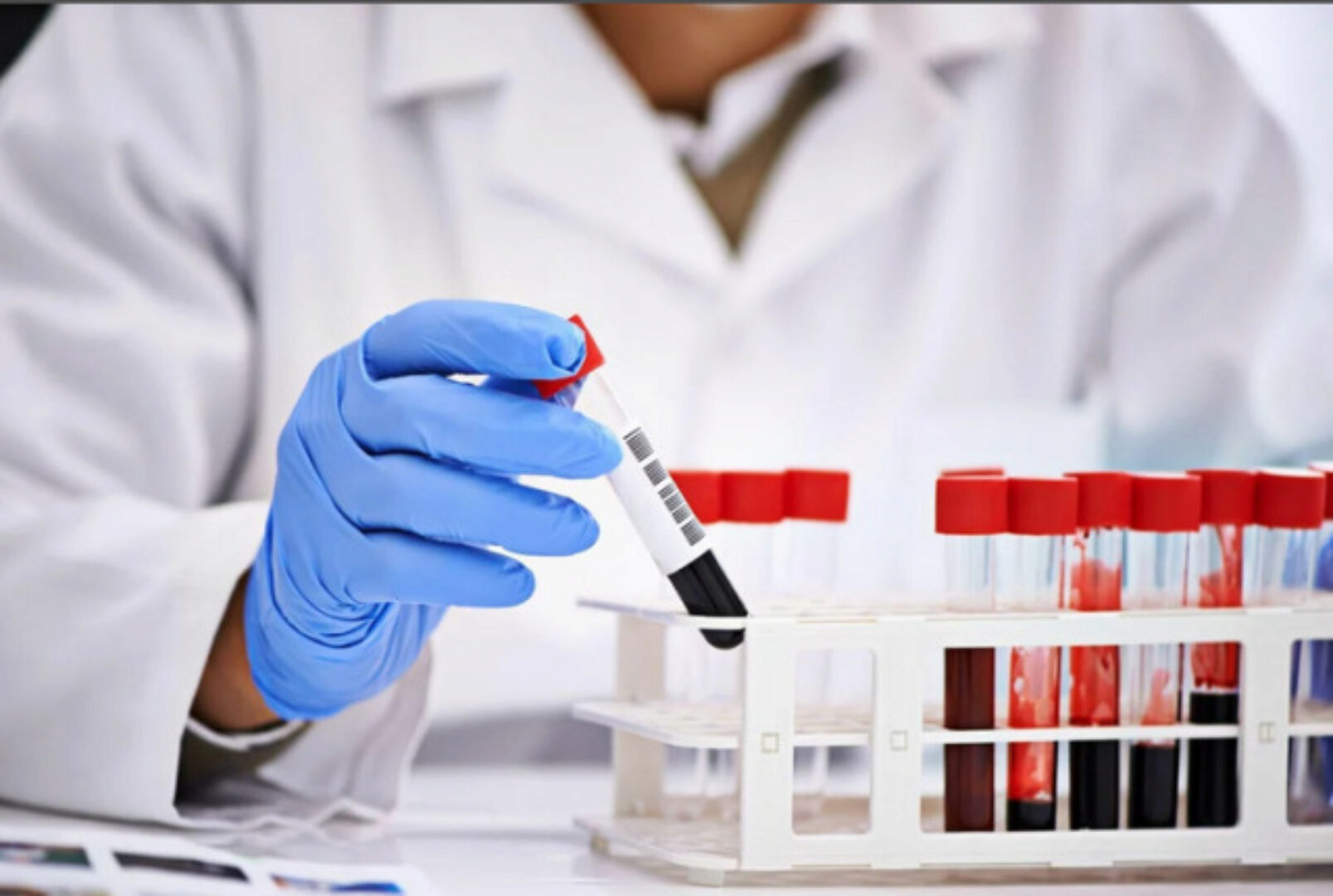 Клинический разбор анализов 4 (Алина Усаинова)