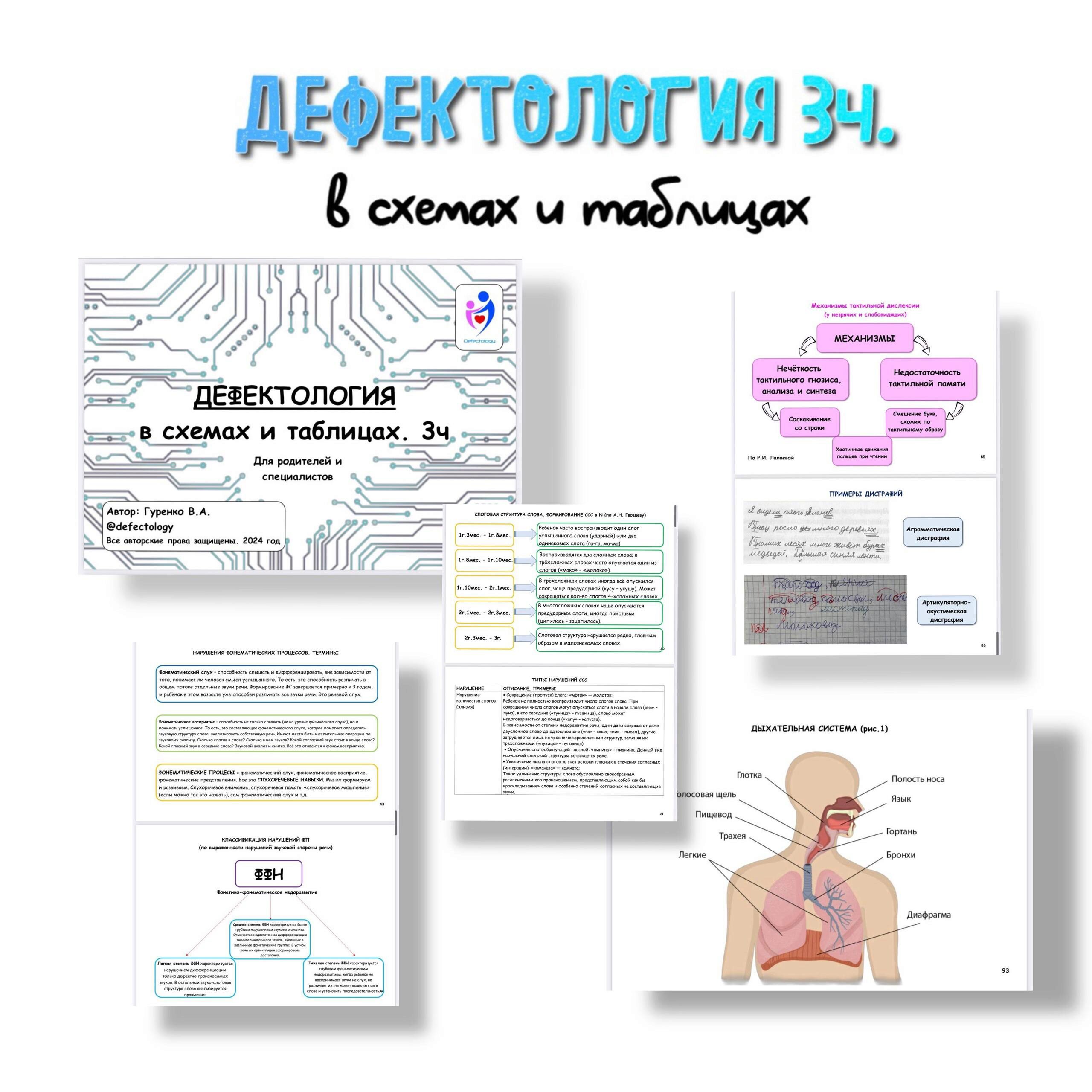 Дефектология в схемах и таблицах 3 часть (Виктория Гуренко)