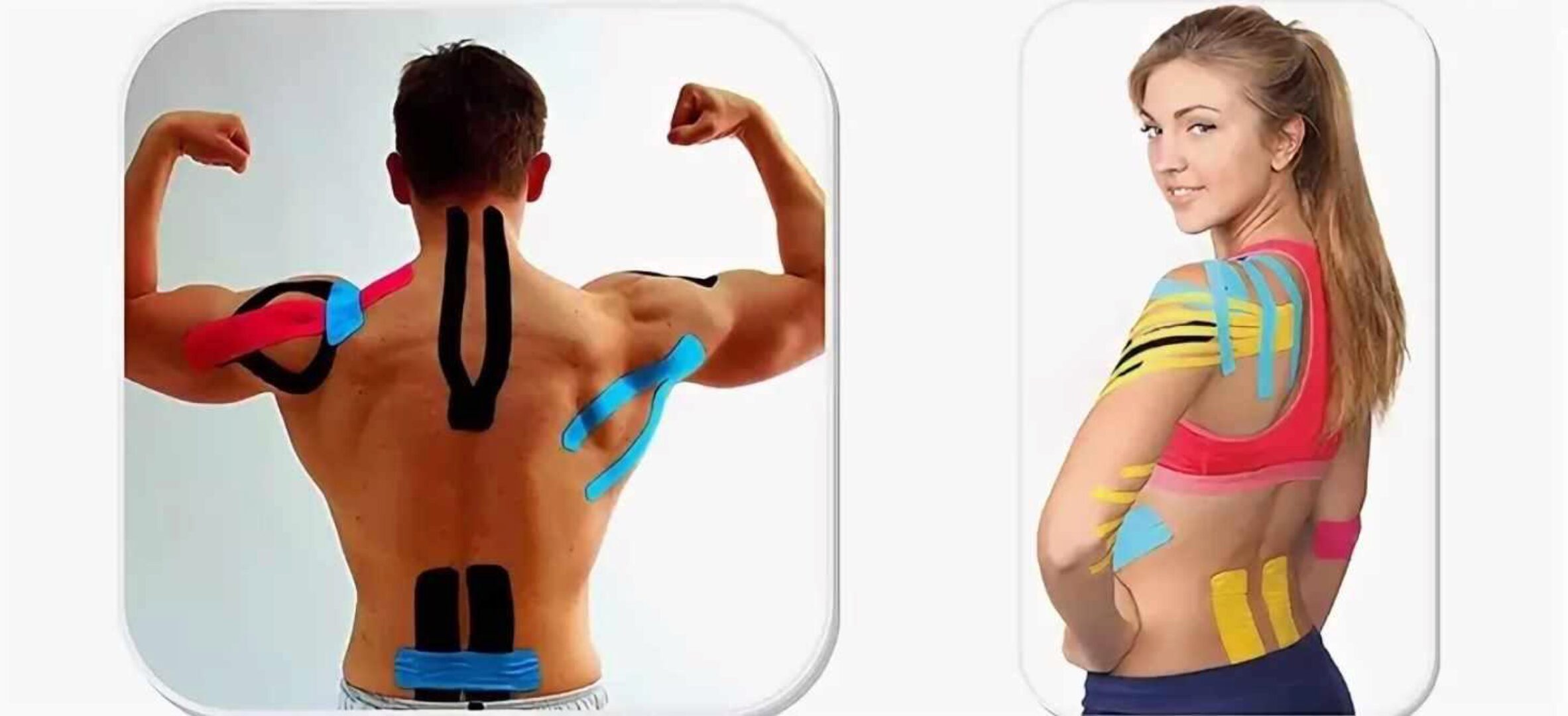 Тейпирование шейно-воротниковой зоны и спины (mavikatte)