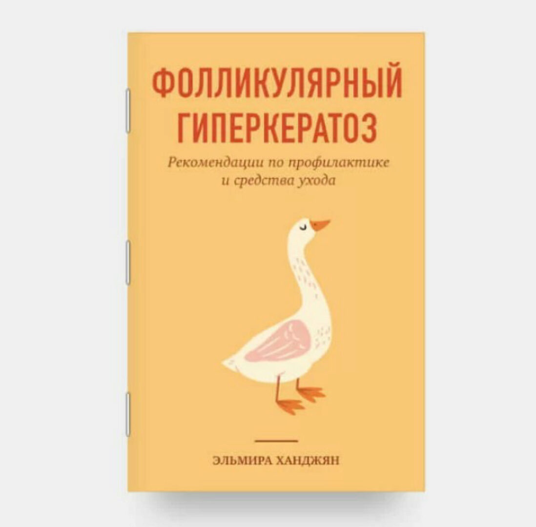 Фолликулярный гиперкератоз (Эльмира Ханджян)