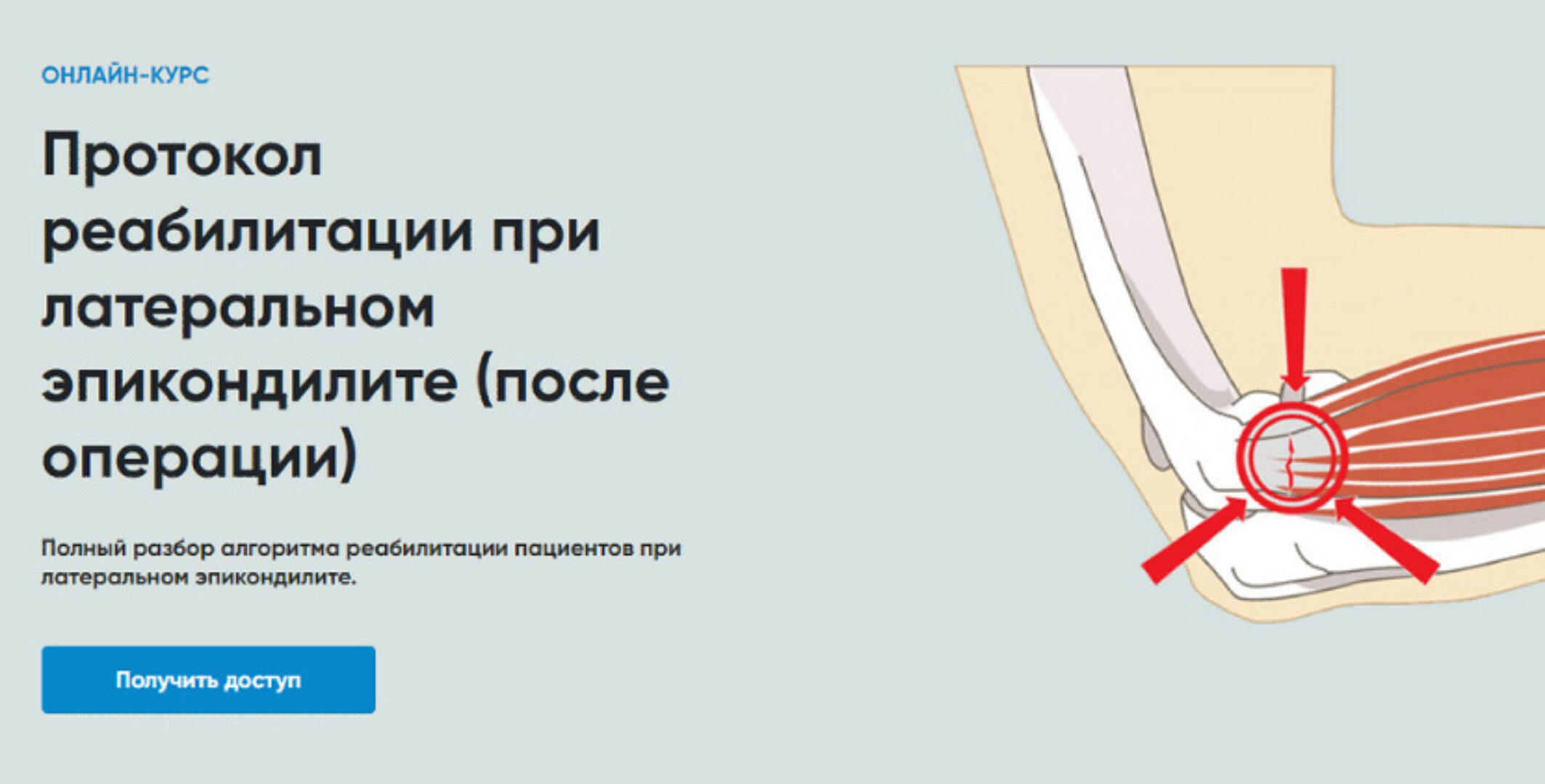 [Rehab Science] Протокол реабилитации при латеральном эпикондилите (после операции) (Андрей Богатырев)