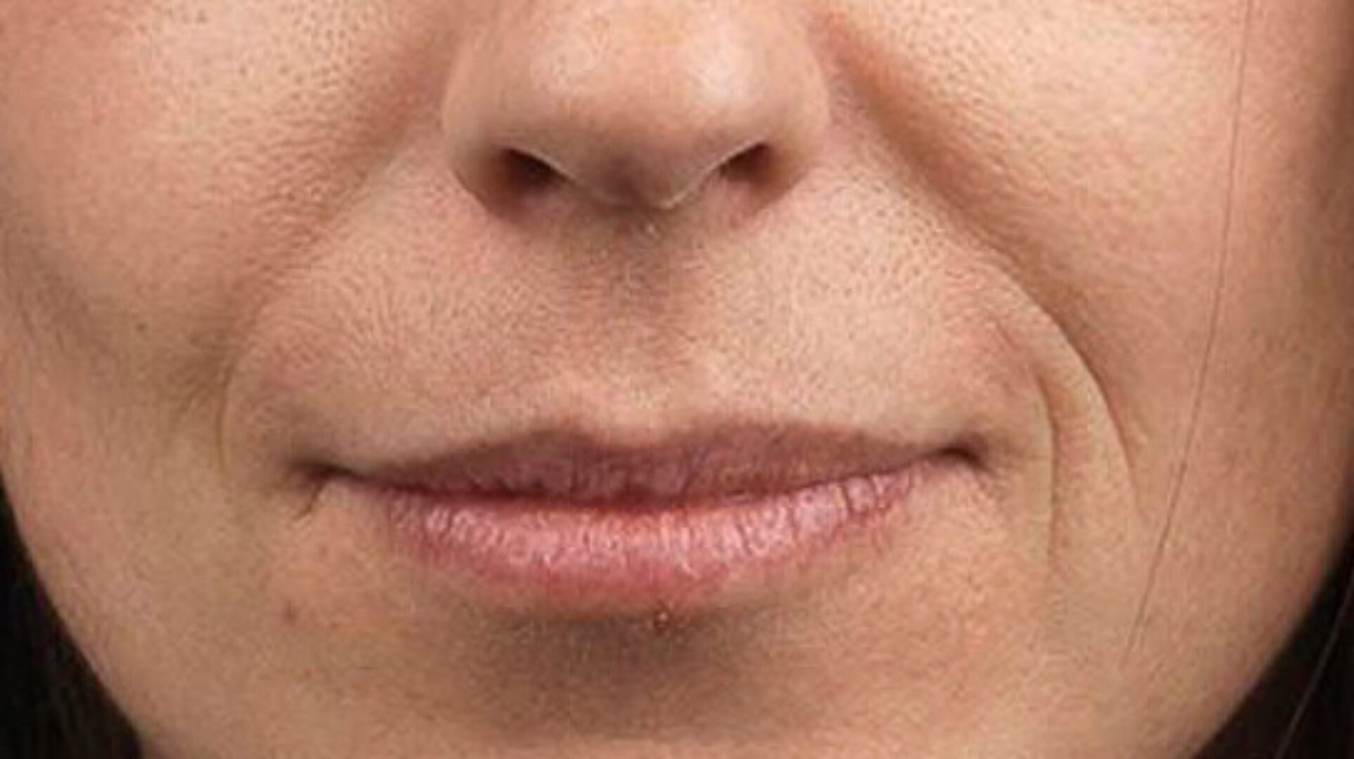 Как убрать носогубные морщины,«брыли»,второй подбородок,подтянуть обвисшие щёки (Алена Россошинская)