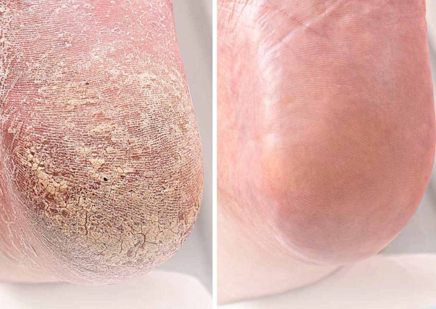 Вебинар Трещины – это просто. Тариф Pro (Ангелина Нышонкова)