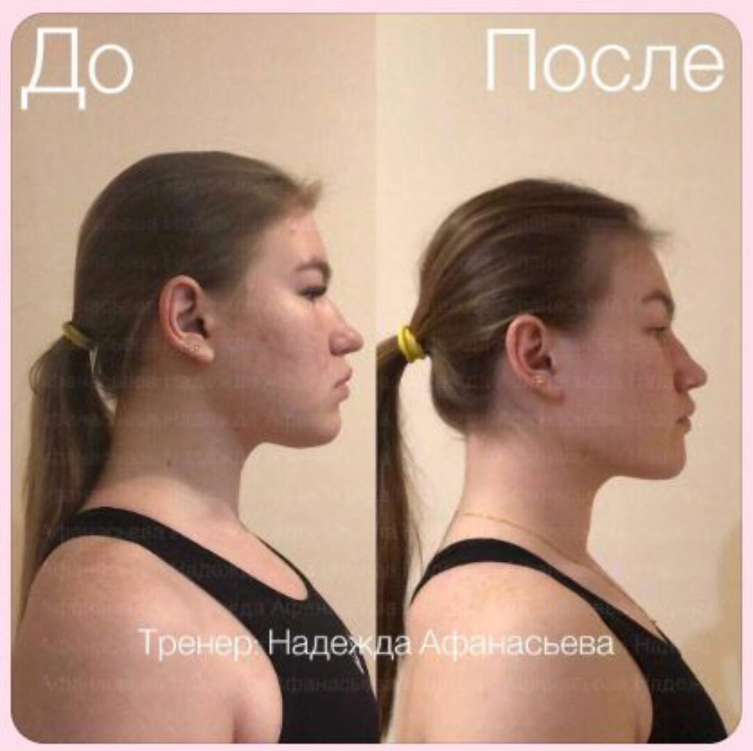 Самомассаж лица и фейсфитнес (Надежда Афанасьева)