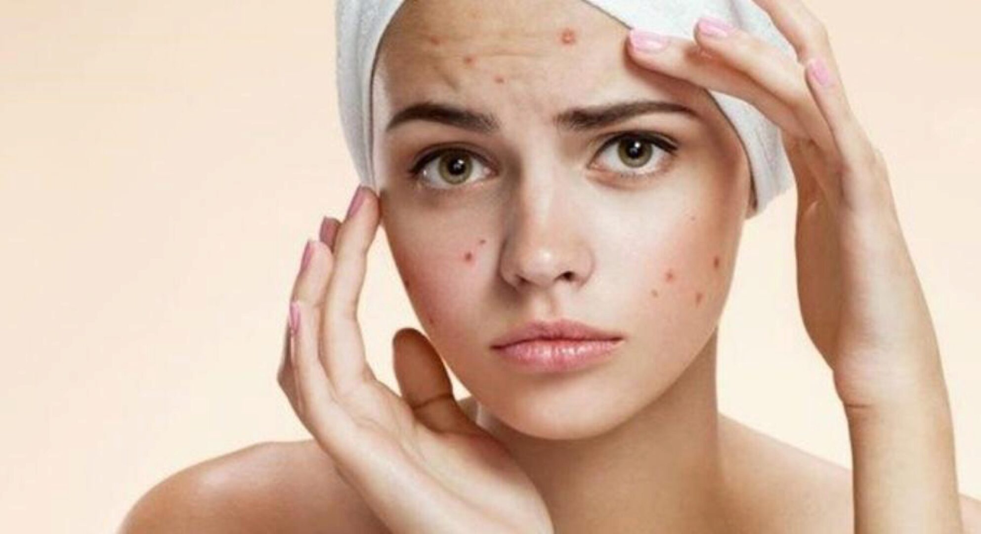 Акне. Здоровая кожа (Елена Корнилова)