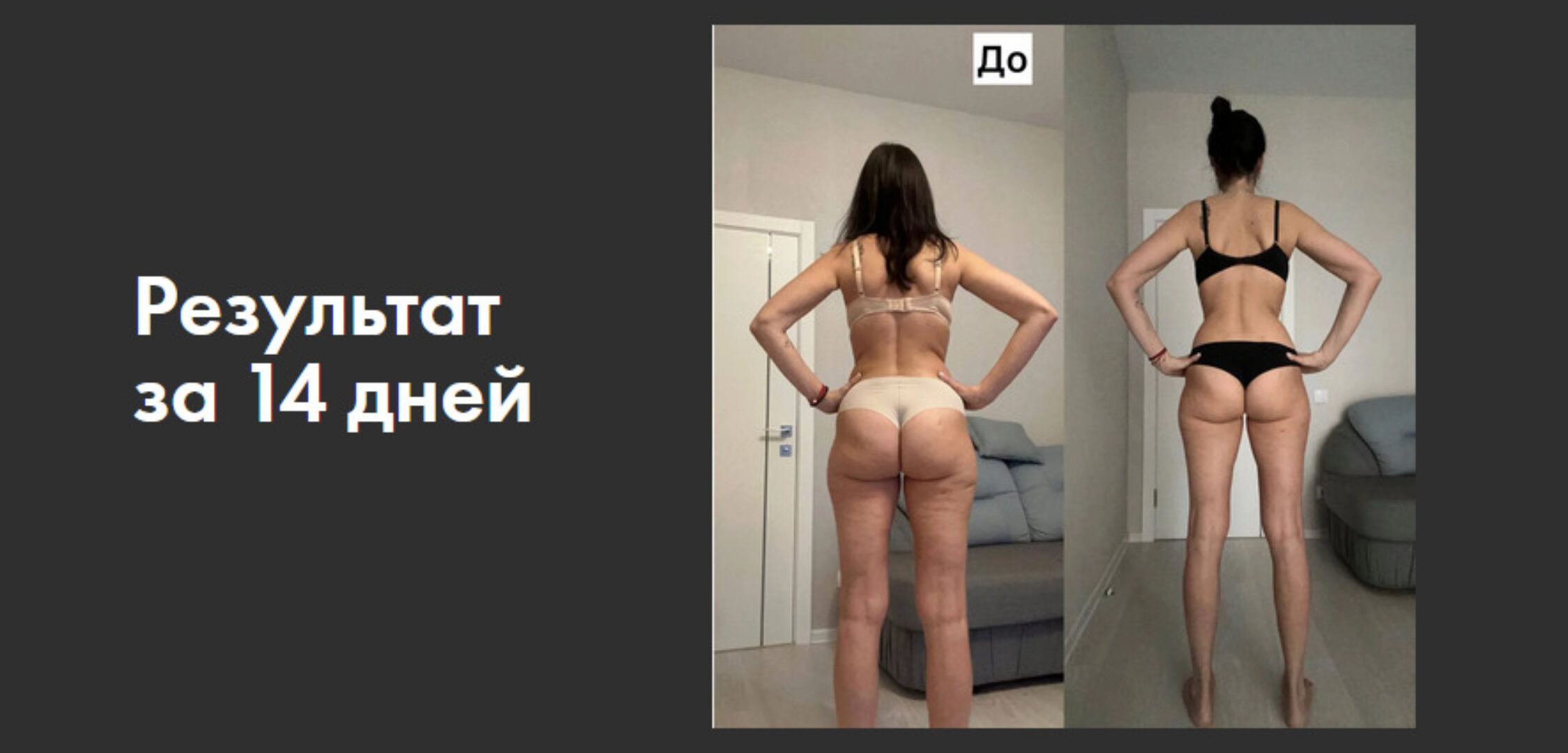 Устранение попиных ушек, уменьшение обьема в талии и бедрах (Сергей Оларь)