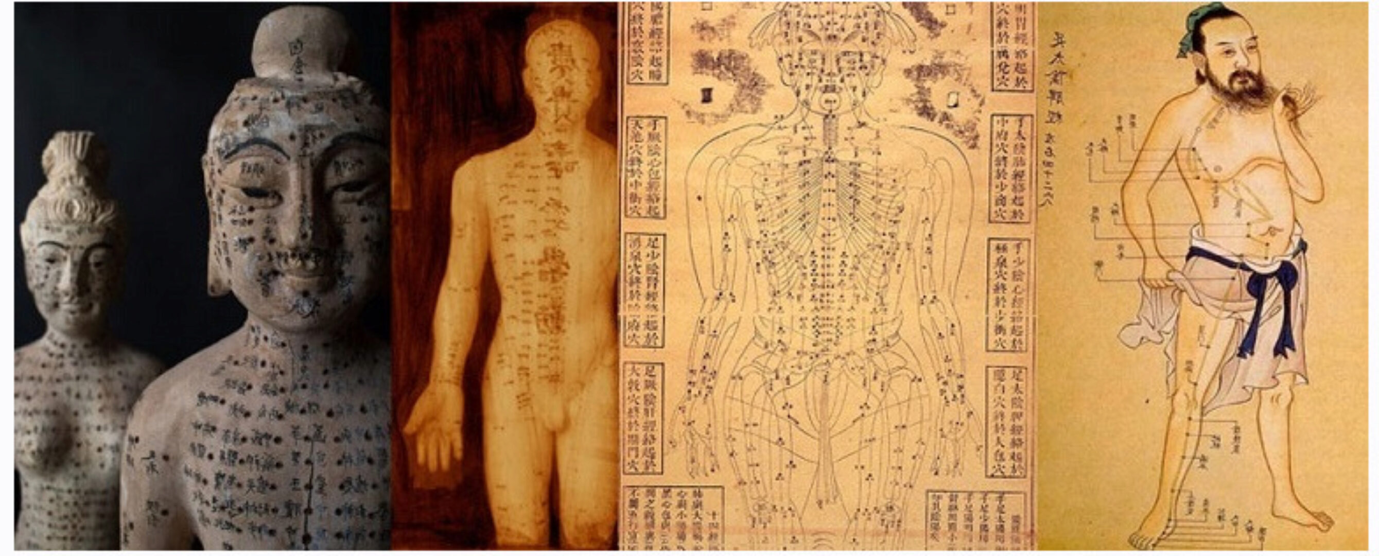 Практические аспекты иглотерапии. Техники введения игл. (Ван Вэй)