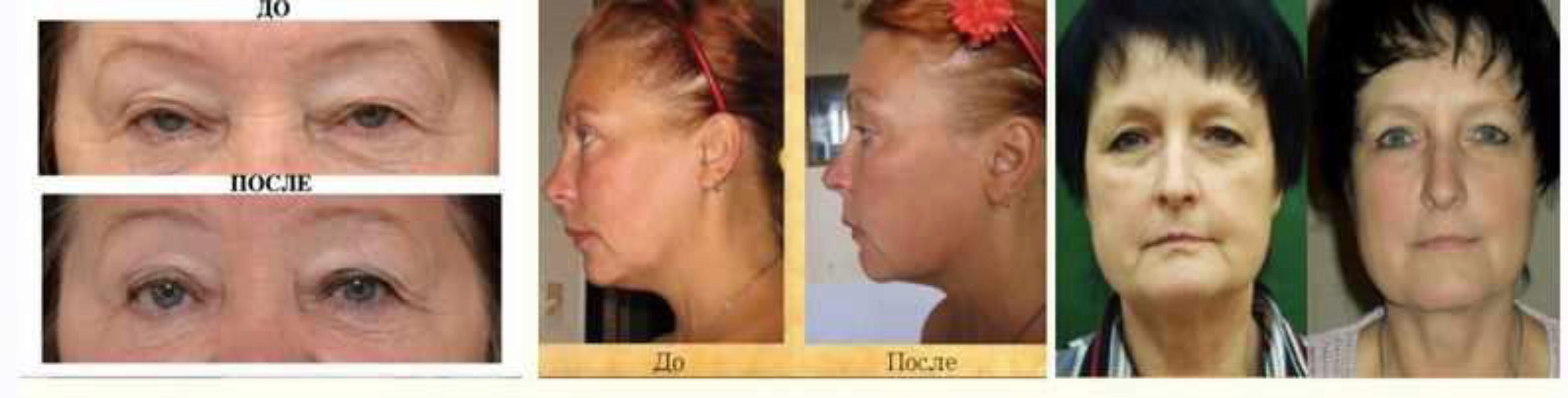 Секреты вечной молодости. ЭкоПластика лица своими руками (Мастер Любичъ)