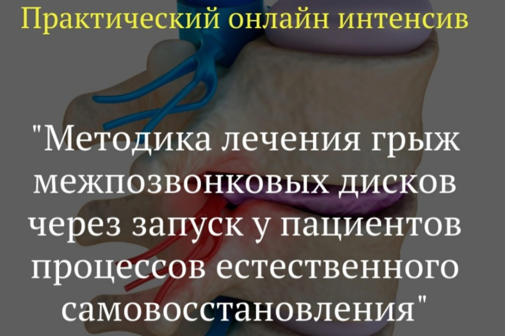 Методика лечения грыж межпозвонковых дисков  (Игорь Атрощенко)