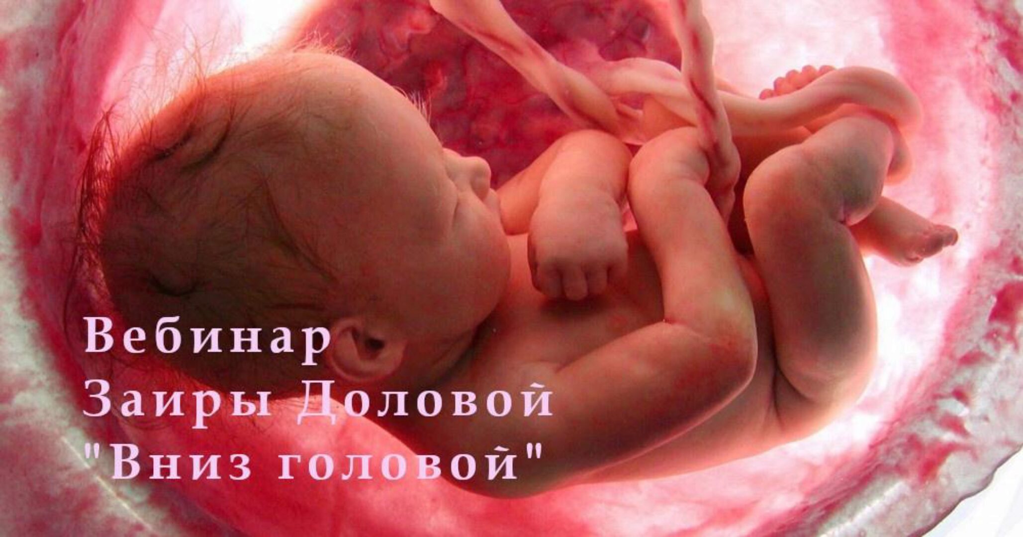 Вниз головой (Заира Долова)