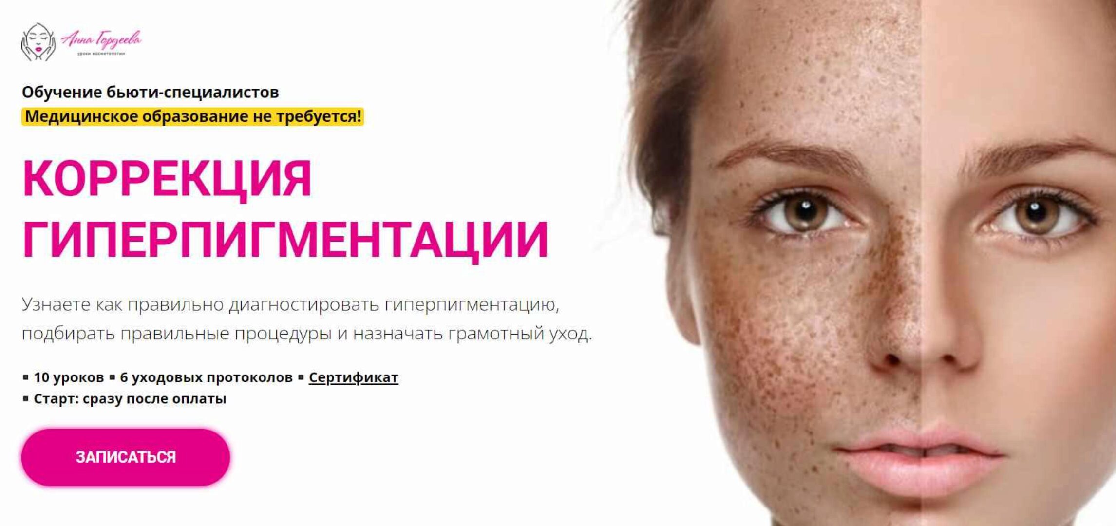 [Edcosmetology] Коррекция гиперпигментации (Анна Гордеева)