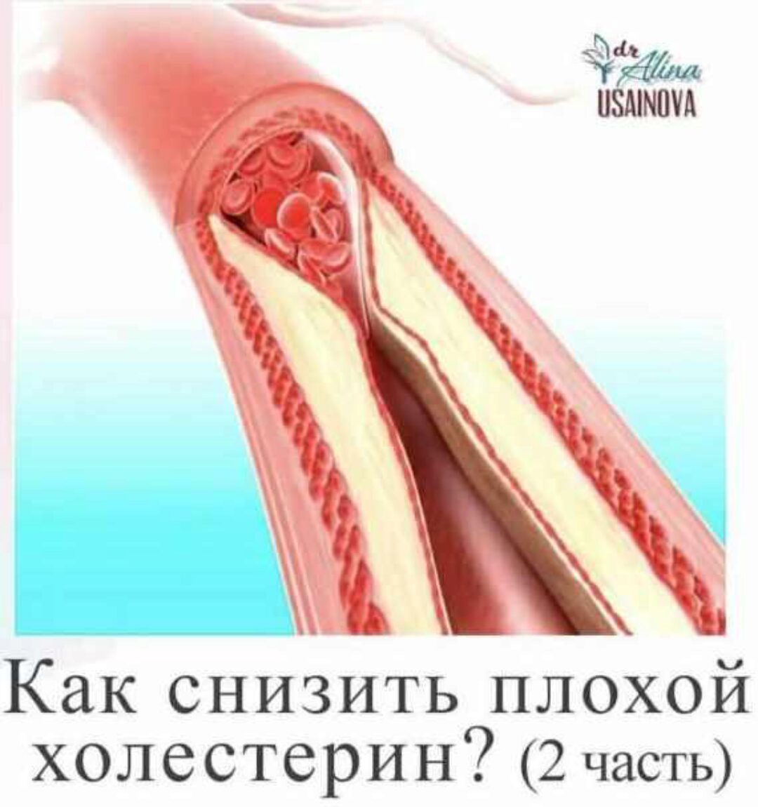 Как снизить плохой холестерин? 2 часть (Алина Усаинова)