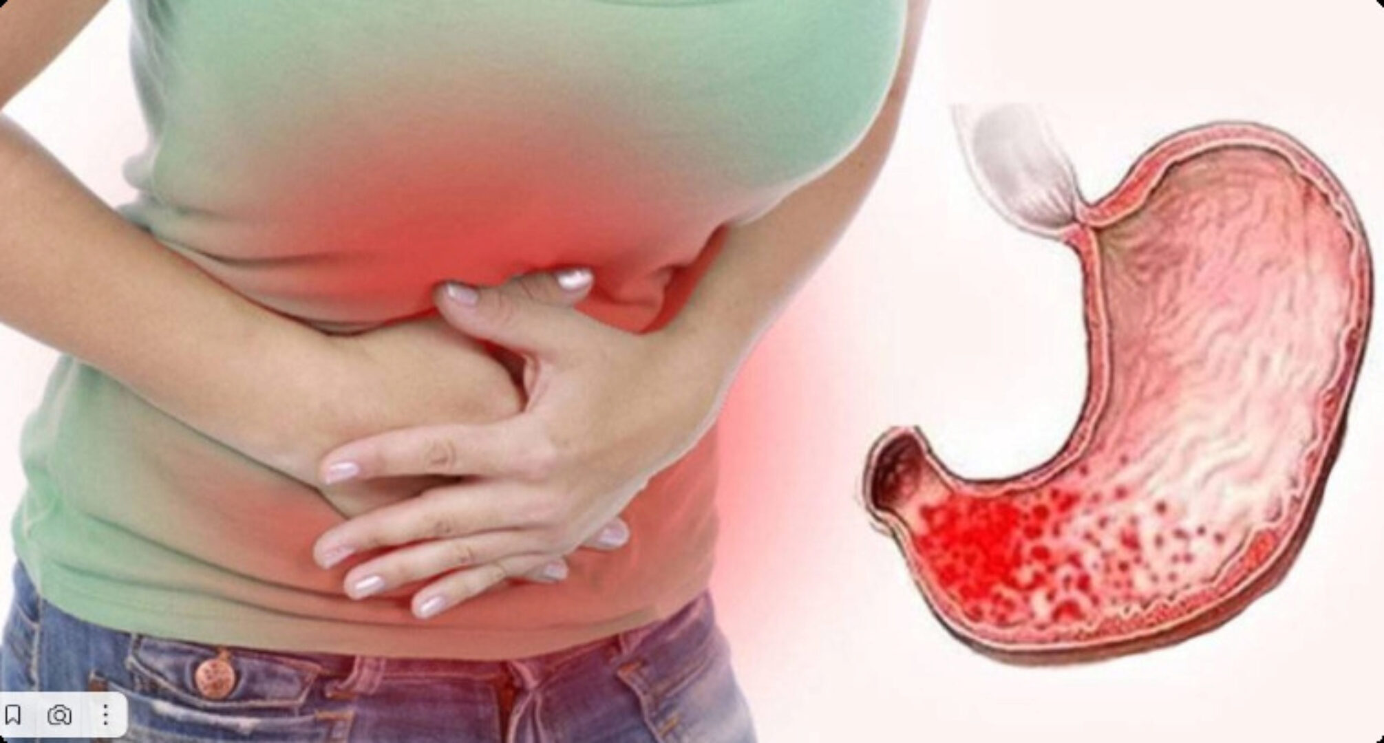 Здоровье и клапанная система ЖКТ (Игорь Кауфман)