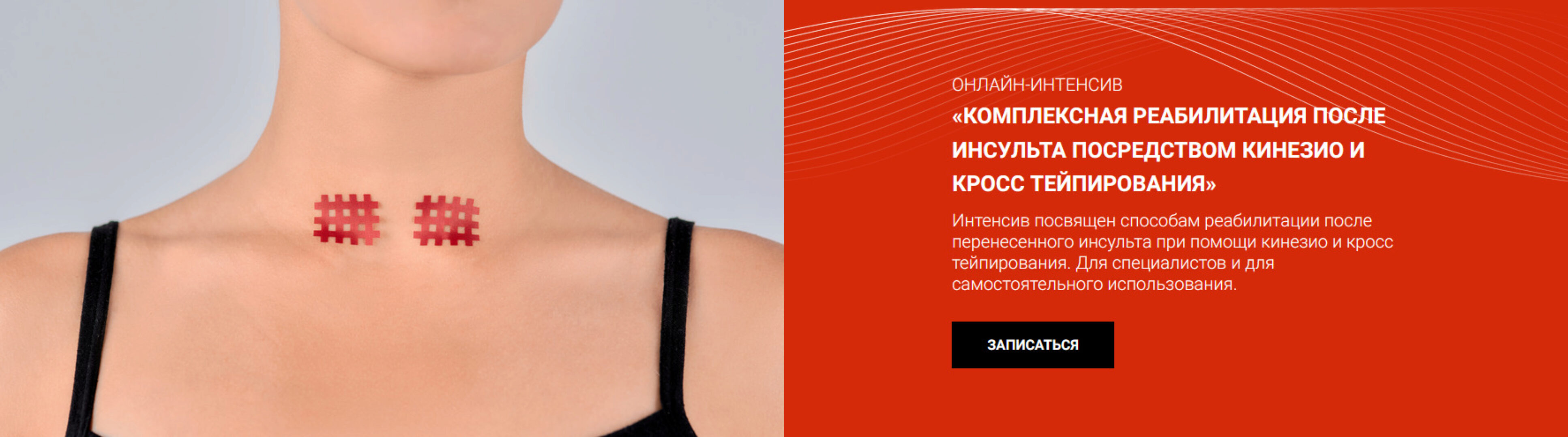 [BBalance] Комплексная реабилитация после инсульта посредством кинезио и кросстейпирования (Валентин Гайт)