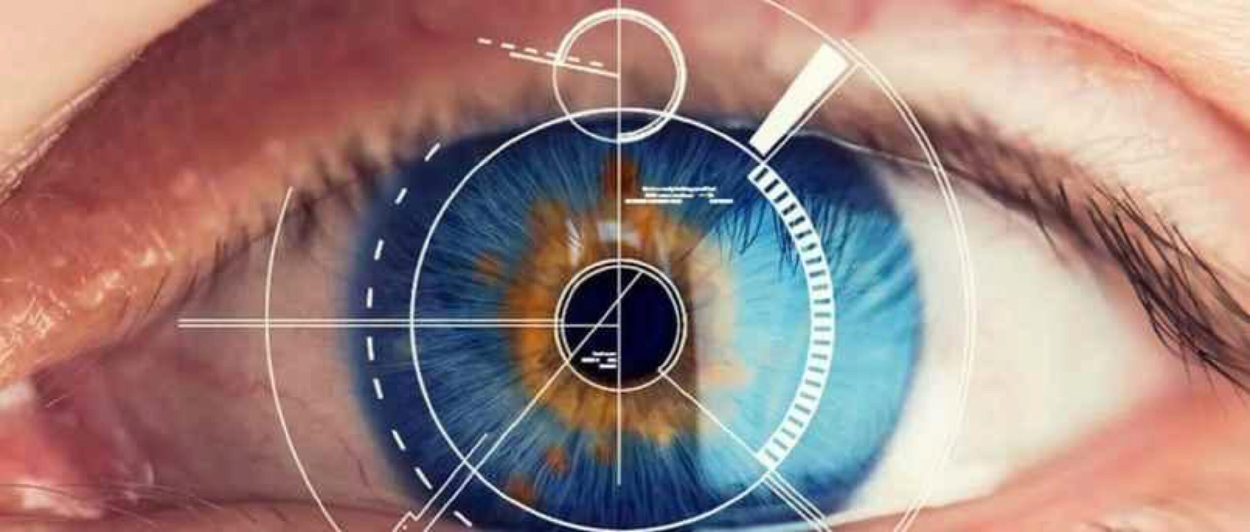 Единая система мануальной коррекции близорукости, дальнозоркости, опущения века (Игорь Атрощенко)