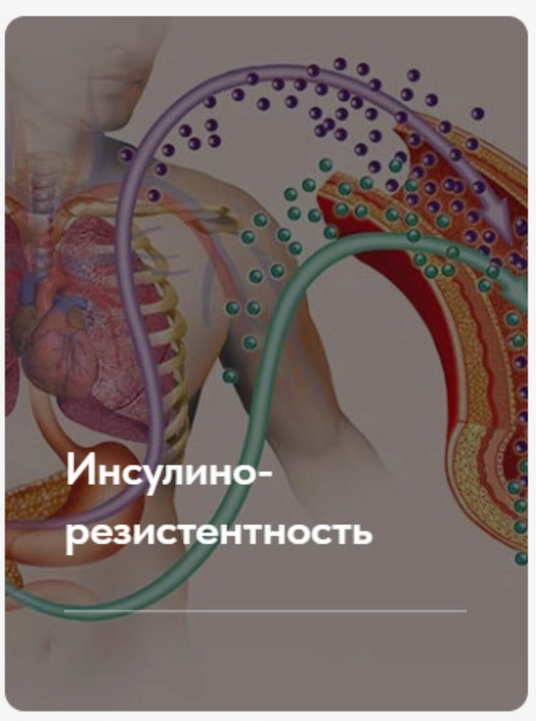 Лечебный протокол Инсулинорезистентность. Тариф Без обратной связи (Елена Ержанова)