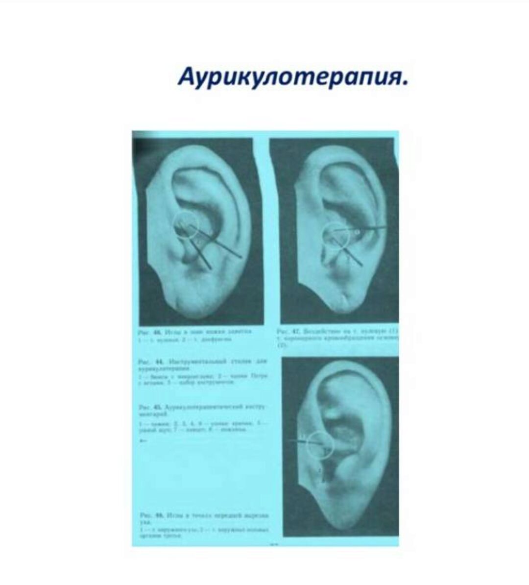 Клиническая аурикулотерапия (Елена Шведова)