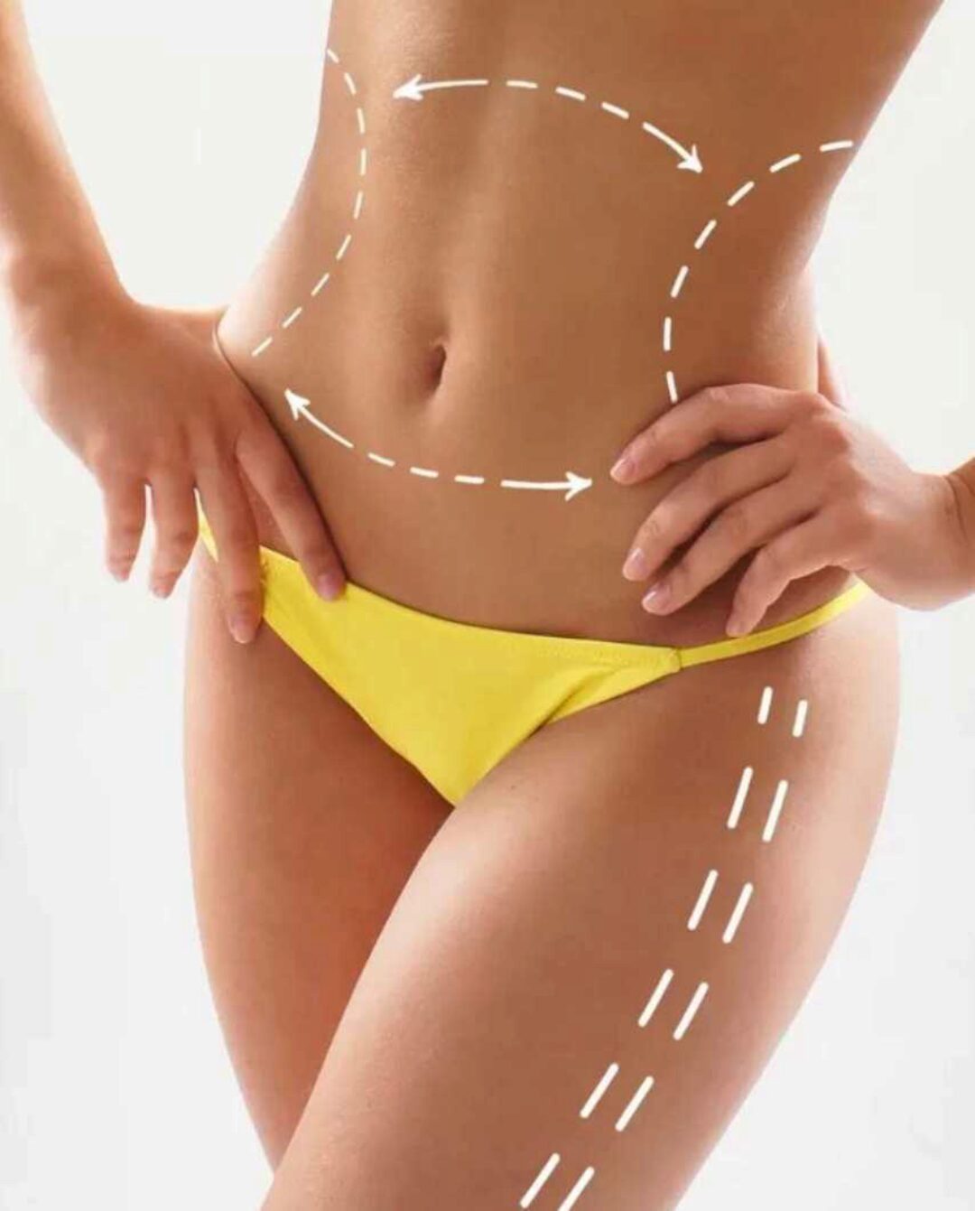 Ручная липопластика тела (Олег Тирский)