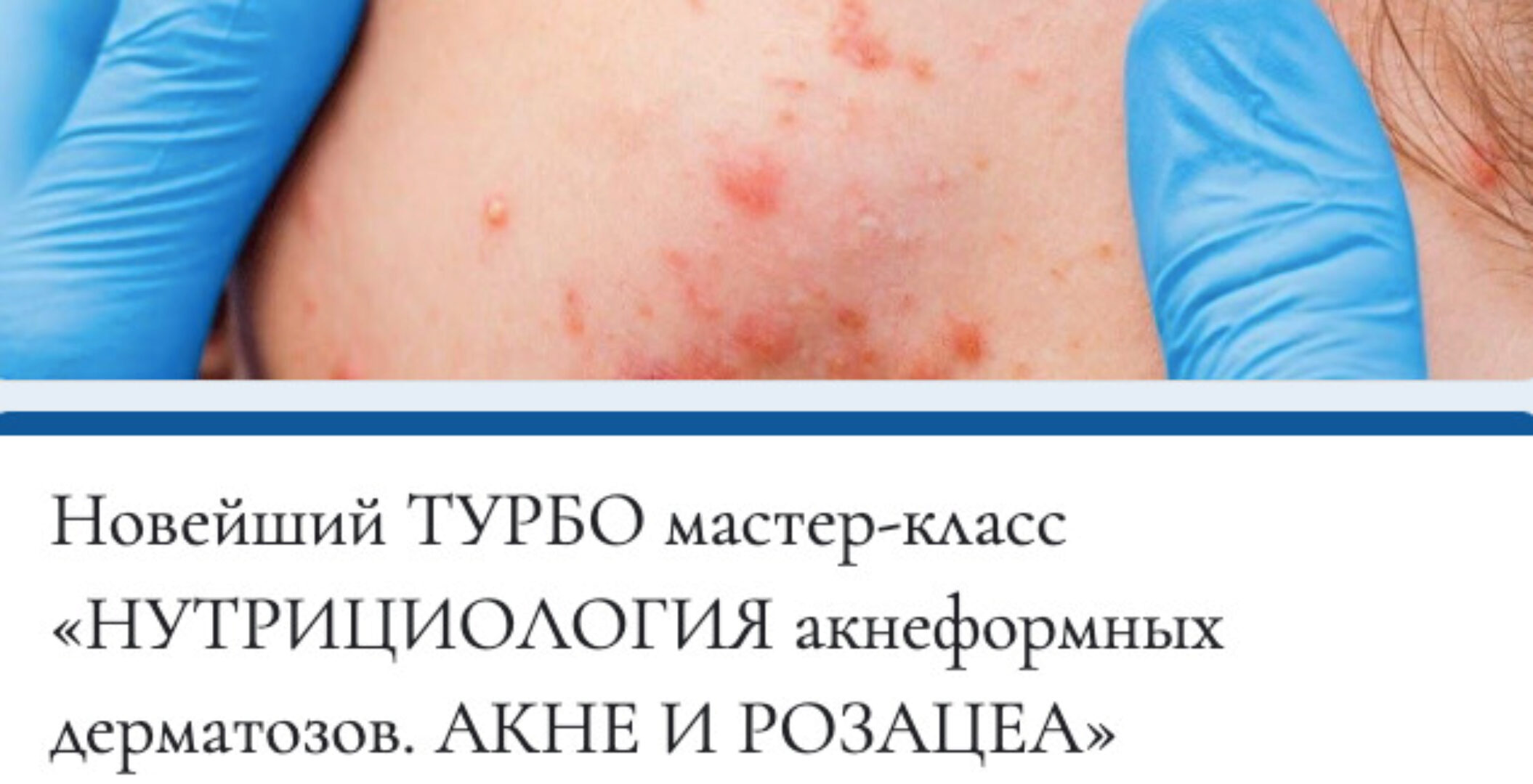 [mokosmed] Нутрициология акнеформных дерматозов. Акне и розацея (Мария Моргунова)