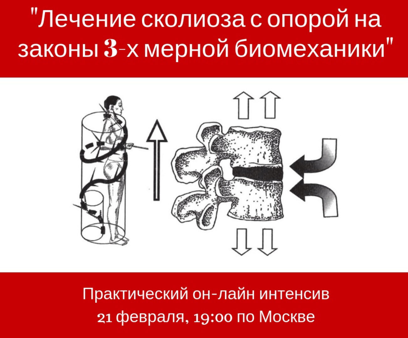 Лечение сколиоза с опорой на законы 3-х мерной биомеханики (Игорь Атрощенко)
