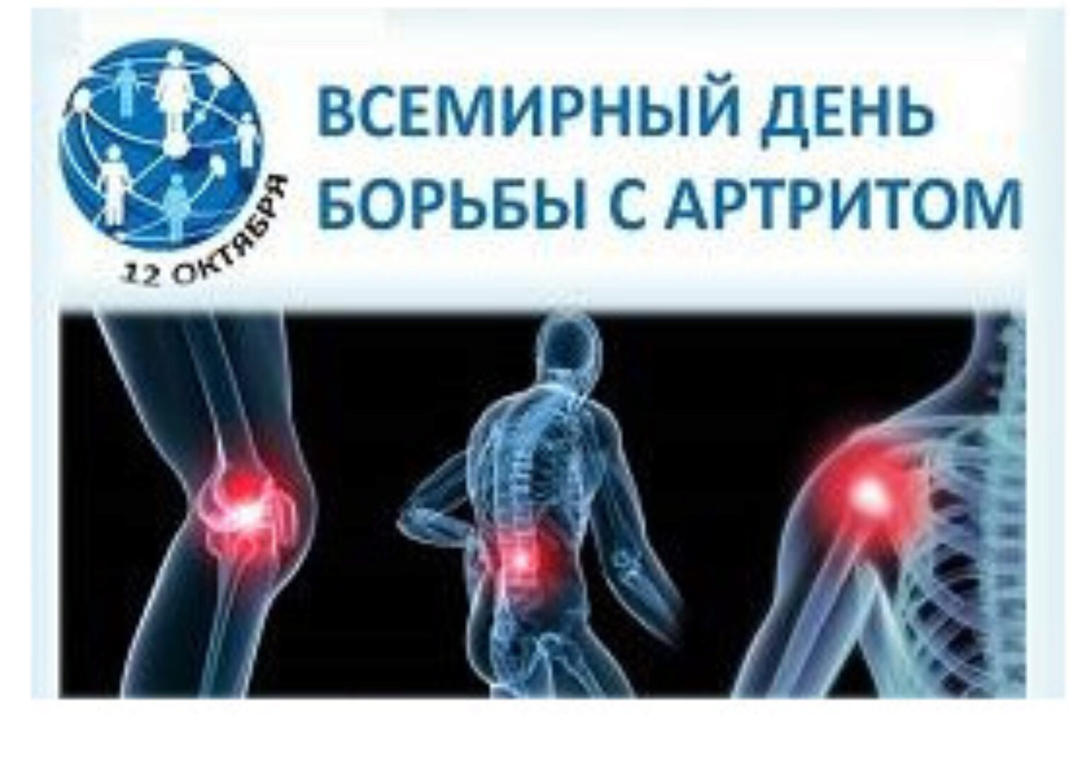 Многомерная медицина. Артрит - не приговор (Баян Якупова)