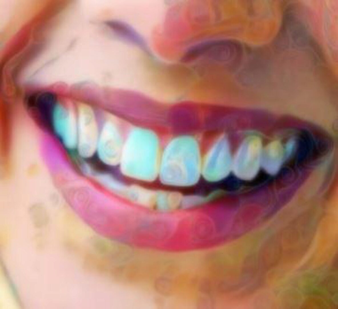 Пропитанные плазмой зубы и десны  (Sapien Medicine)