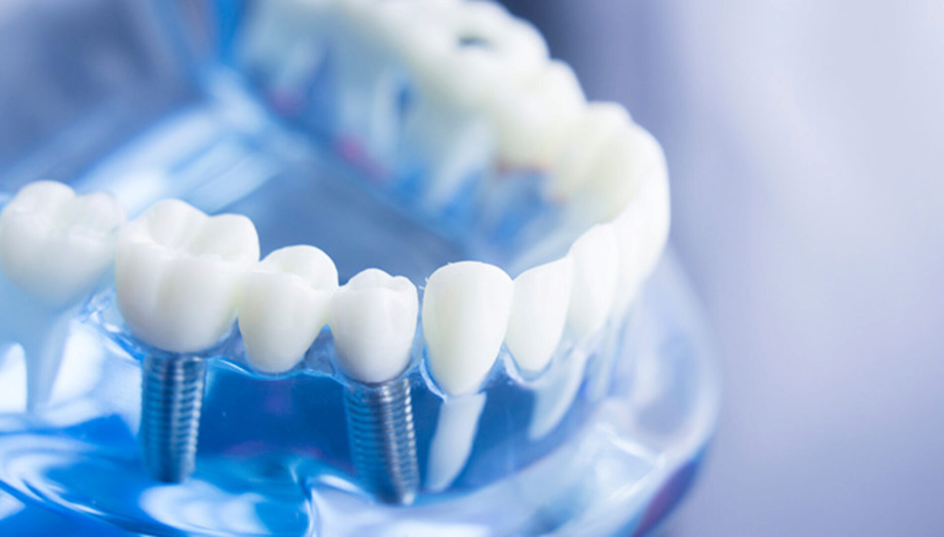 Зубная серия - Повторный рост зубов (Архангел Вознесения)