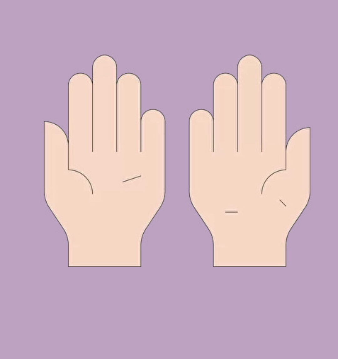 [МГХПА] Плечо, предплечье, кисть (Александр Рыжкин)