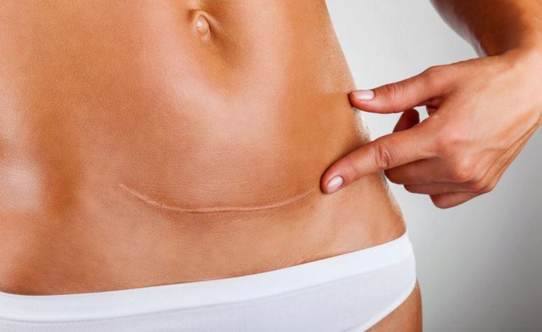 [BBalance] Работа с рубцами с помощью кинезио и кросс тейпирования (Валентин Гайт)