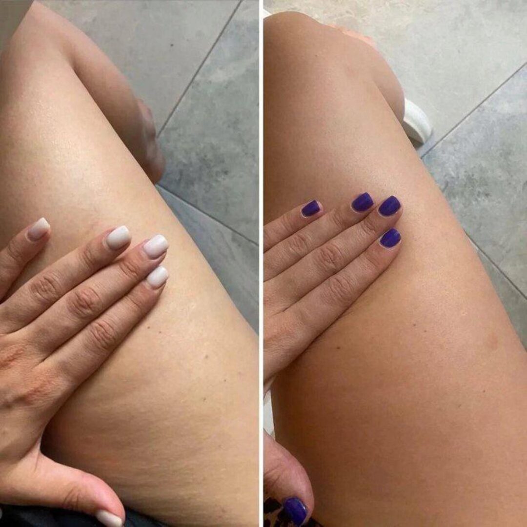 Антидряблость (Оксана Килина)