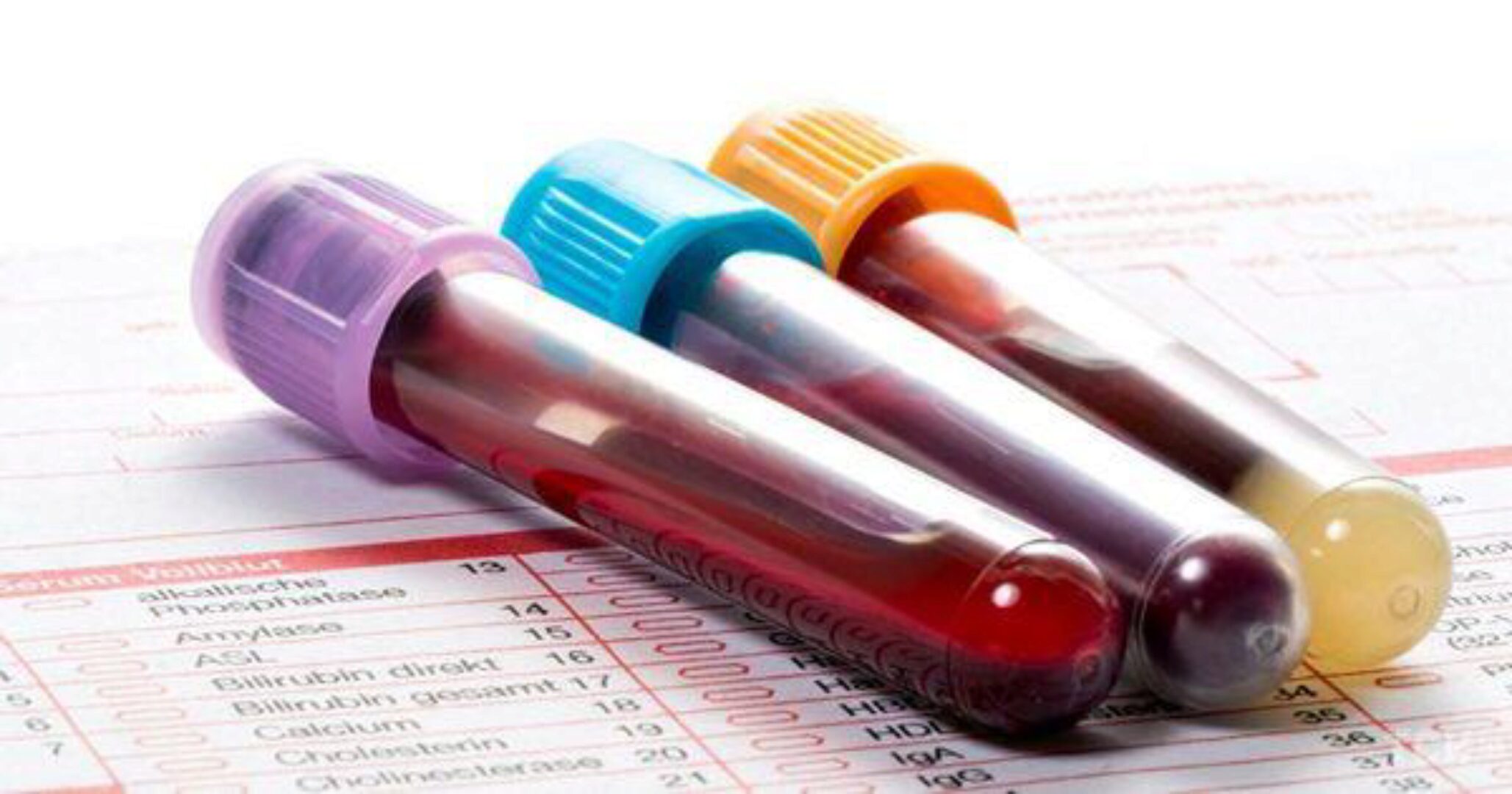 Как читать анализы (Александра Петренко)