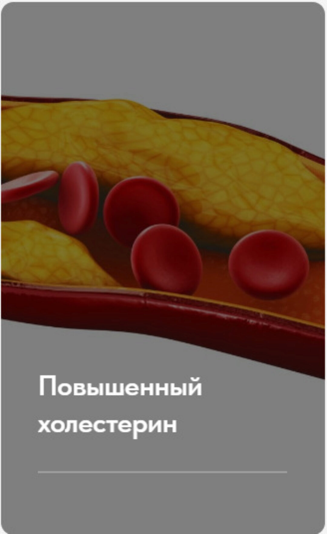 Лечебный протокол Повышенный холестерин. Тариф Без обратной связи (Елена Ержанова)