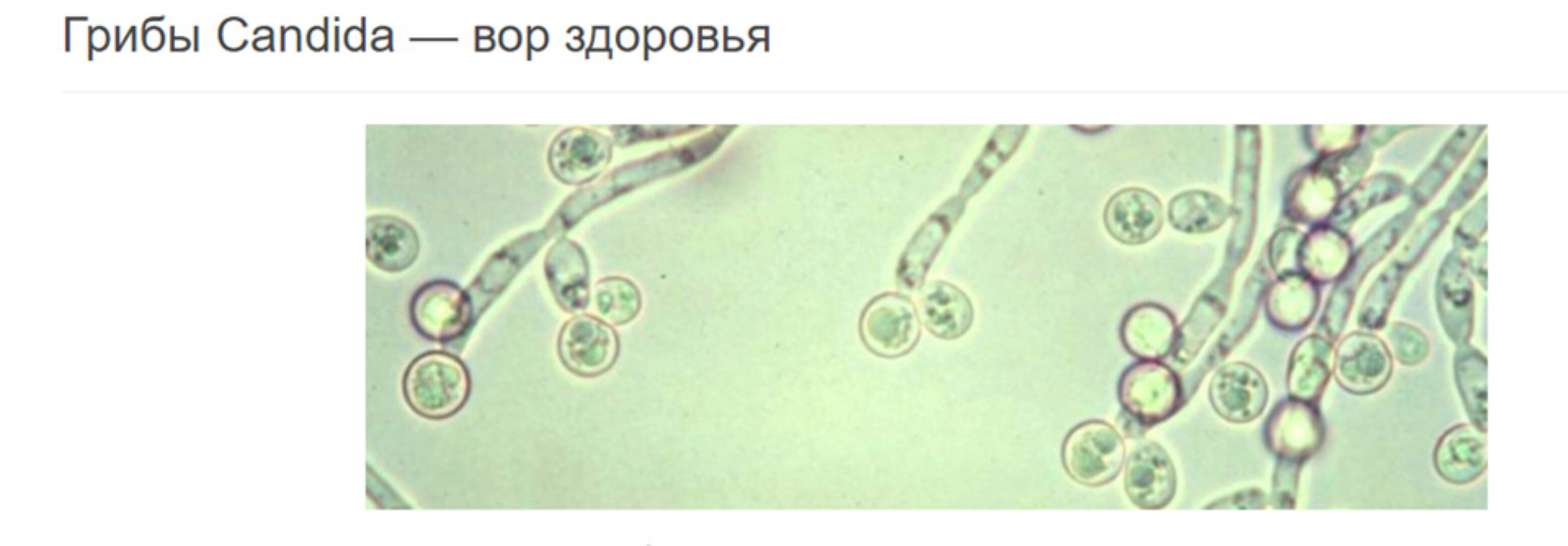 Противогрибковая, противопаразитарная программы (Елена Бахтина)
