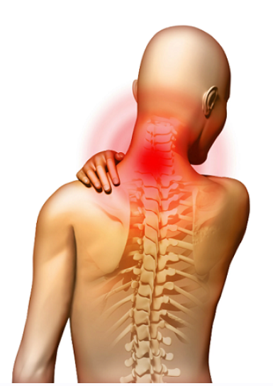Шея: биомеханика и коррекция распространенных патологий. Холка, вдовий горб. Протракция, голова вперед. Неспецифические боли (Александр Волоткевич)